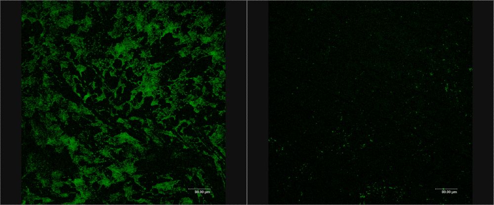 Biofilmbildung auf Osmosemembranen Umkehrosmose Bakterien Biofouling Membran