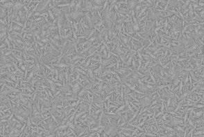 Scanning electron micrograph of a LEAZit structure. Graues Rastermuster